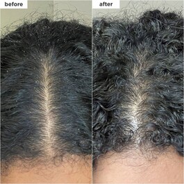 Scalp Revival - Shampoo micro-esfoliante Formato Viaggio