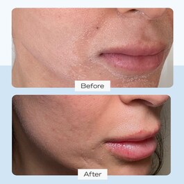 Ultra Repair Cream - Crema idratazione intensa per viso e corpo