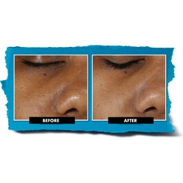 Rare Earth Deep Pore Cleansing Masque - Maschera Viso Purificante