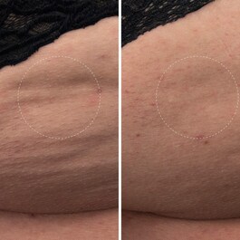 The Body Cream - Crema idratante per il corpo