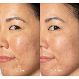 Glow 2OH Dark Spot Toner - Tonico Viso anti-macchie con AHA