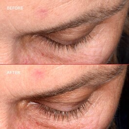 Lashbond™ - Siero Per Ciglia