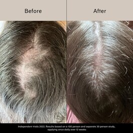 Pitta Growth Serum - Siero di crescita