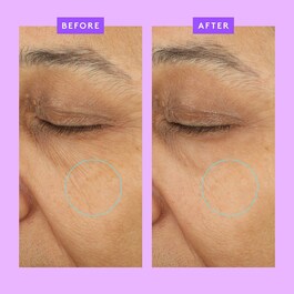 Ceramighty™ AF Eye Balm - Crema Contorno Occhi Antirughe
