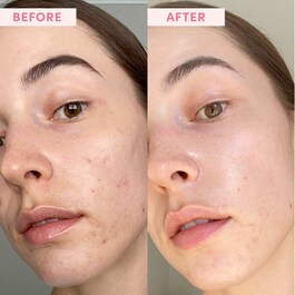 Australian Pink Clay - Maschera Viso Argilla Rosa