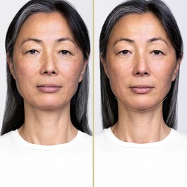 LiftDefine Radiance Night Concentrate - Trattamento Notte