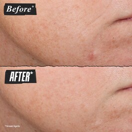Retinol Skin-Renewing Daily Micro-Dose Serum - Siero antirughe