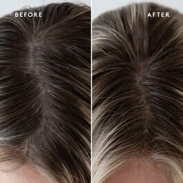 Topical Scalp Supplement - Siero Cuoio Capelluto