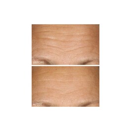 Vitamin C + Lactic - Siero concentrato illuminante rassodante 15% di vitamina C