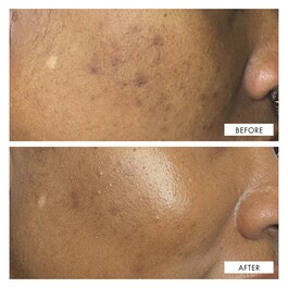 Dark Spot Correcting Serum - Siero Correttore Delle Macchie Scure