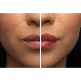 Lip Injection - Balsamo per labbra