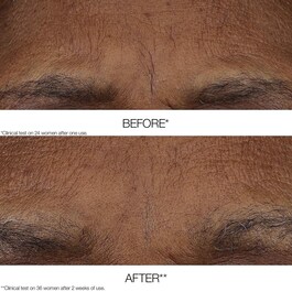 Clinique Smart Clinical Repair™ AM/PM Retinoid Balm - Trattamento antietà