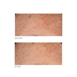 Alpha Beta® - Peeling quotidiano a formula universale