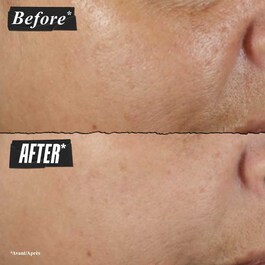 Rare Earth Deep Pore Cleansing Masque - Maschera Viso Purificante