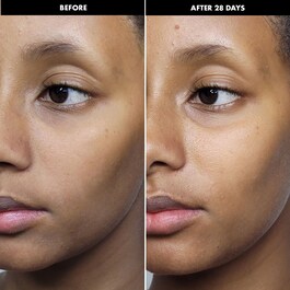 Crema lenitiva - Crema viso idratante e nutriente