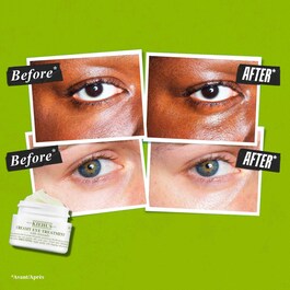 Creamy Eye Treatment with Avocado - Contorno occhi idratante 