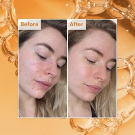 Radiance Ready Steady Aha - Tonico Viso
