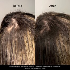 Pitta Growth Serum - Siero di crescita