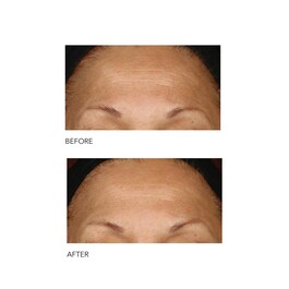 Alpha Beta® - Peeling quotidiano a formula intensiva