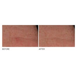 Advanced Retinol + Ferulic - Crema notte concentrata antirughe