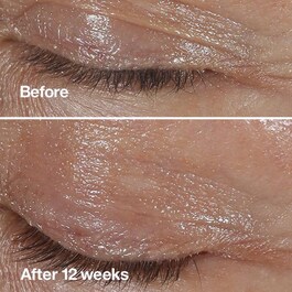 Clinique Smart Clinical Repair TM Wrinkle Correcting Serum - Siero Viso