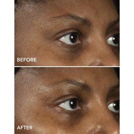 DermInfusions - Maschera Contorno Occhi Liftante + Rigenerante