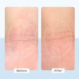 Ultra Repair Cream - Crema idratazione intensa per viso e corpo