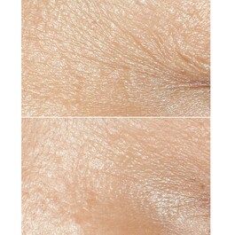 Smart Clinical Repair™ Wrinkle Correcting Cream All Skin Types - Crema antirughe
