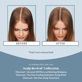 Scalp Revival Charcoal - Trattamento per il cuoio capelluto
