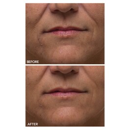 Alpha Beta® - Peeling quotidiano ultra delicato