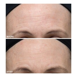 Alpha Beta® - Peeling quotidiano ultra delicato