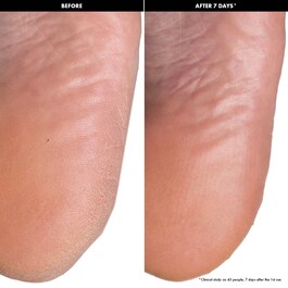 Maschere Peeling per i Piedi - Maschere esfolianti per i piedi