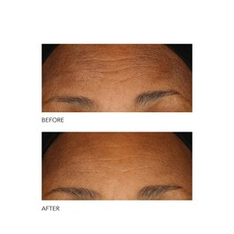 Alpha Beta® - Peeling quotidiano a formula intensiva