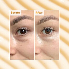 La cura Radiant Eye  - Contorno occhi  Anti-Occhiaie