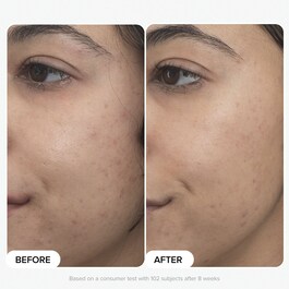 Clinical - Siero Retinaldeide duo PRO
