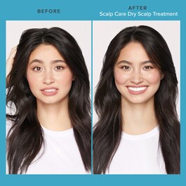 Scalp Care Dry Scalp Treatment  - Riequilibrante per il cuoio capelluto