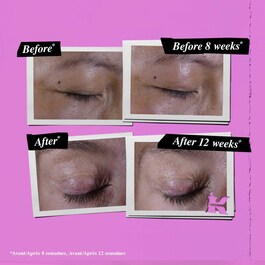 Super Multi-Corrective Eye Zone Treatment - Crema contorno occhi