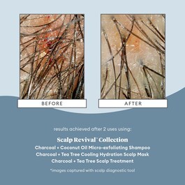 Scalp Revival Charcoal - Trattamento per il cuoio capelluto