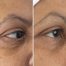 The Eye Cream - Crema Occhi