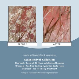 Scalp Revival Charcoal - Trattamento per il cuoio capelluto
