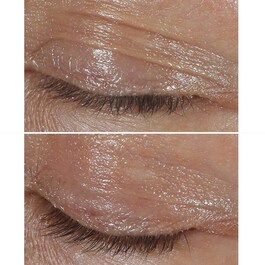 Clinique Smart Clinical Eye - Contorno Occhi 