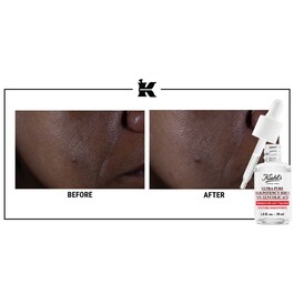 Ultra Pure High-Potency Serum 9.8% Glycolic Acid - Siero Esfoliante Viso