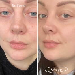 Rosehip Bioregenerate - Universal Rosehip Face Oil