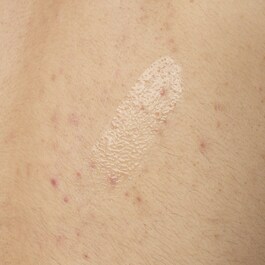 Siero corpo all'acido salicilico 0,5% - Siero anti-imperfezioni per il corpo