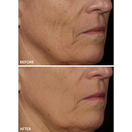 FaceWare Pro - Maschera Viso LED