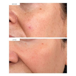 Dark Spot Correcting Serum - Siero Correttore Delle Macchie Scure