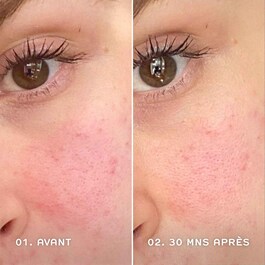 Evercalm™ - Siero viso anti-rossori lenitivo