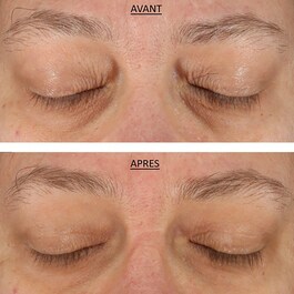 FAB Skin Lab Retinol & Hyaluronic Acid Eye Cream - Crema al retinolo