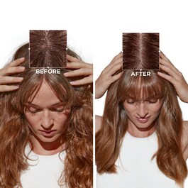 Symbiose Bain Crème Anti-Pelliculaire - shampoo per cuoio capelluto sensibile