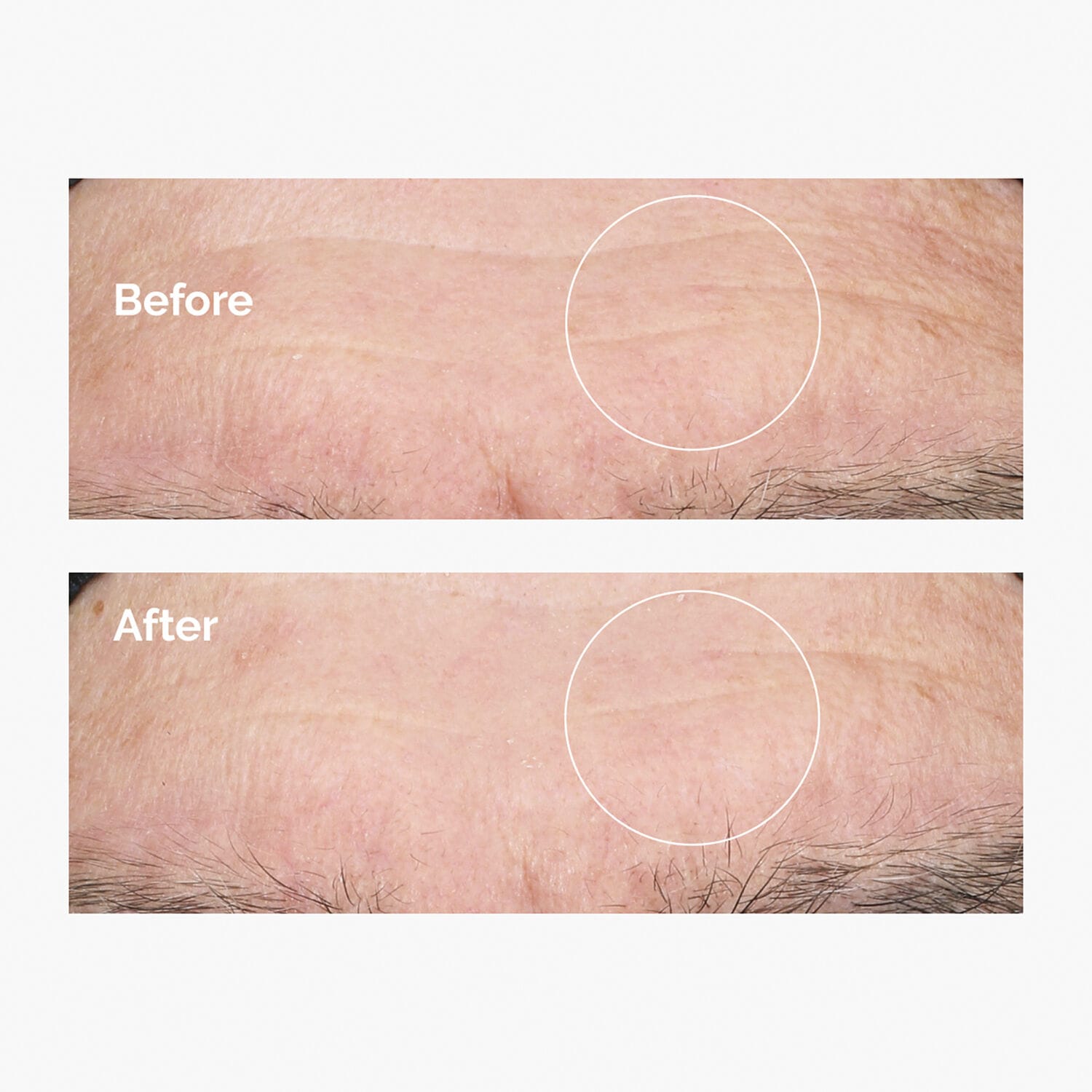 The Ordinary Acido Ialuronico 2% B5-60ml - Foto 12